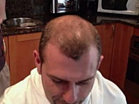 薄毛用ふりかけの威力がヤバい。ささっと振って馴染ませるともう黒々安心！