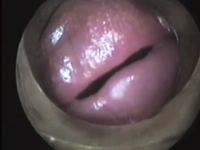 トロンボーンおじさんが演奏している時の唇の振動を内側から撮影してみた。